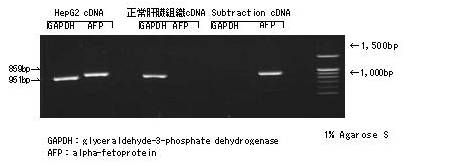 双链特异性直接消化cDNA削减试剂盒