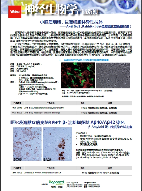 鼠源Iba1抗体，无标签，单克隆抗体（NCNP24）