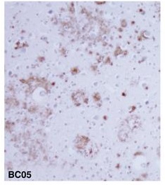 β淀粉样蛋白-免疫组织染色试剂盒
