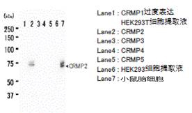抗CRMP2，单克隆抗体（9F）