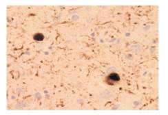 抗磷酸化α-突触核蛋白，单克隆抗体（pSyn＃64）