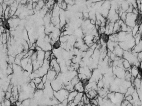 NCNP24鼠源无标签抗Iba1，单抗（NCNP24）-疾病研究