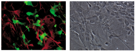 日本和光Wako疾病研究小胶质细胞/巨噬细胞特异性蛋白Iba1抗体（免疫组化）-疾病研究