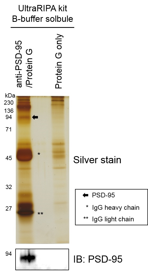 UltraRIPA 脂筏提取缓冲液套装-蛋白研究