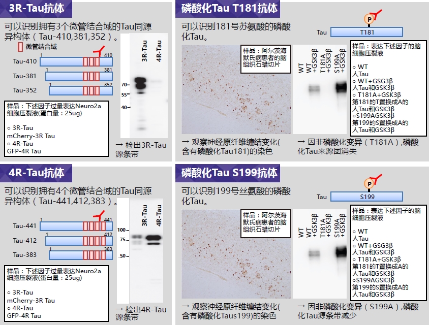 抗3R-Tau，大鼠单克隆抗体（2A1-1F4） Anti 3R-Tau, Rat Monoclonal Antibody(2A1-1F4)-WAKO和光纯药