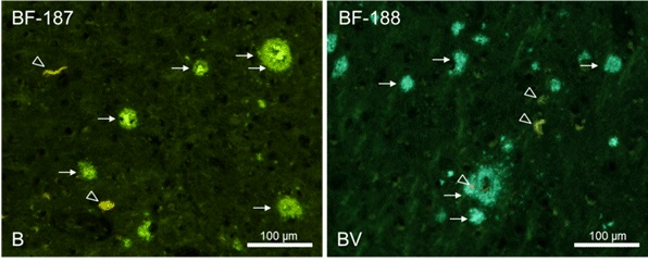 BF-188 阿尔兹海默症特异性荧光探针-188-WAKO和光纯药