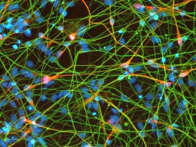 干细胞来源的神经细胞-Reprocell
