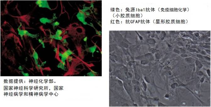 兔源Iba1抗体（免疫组化）小胶质细胞/巨噬细胞特异性蛋白抗体-WAKO和光纯药