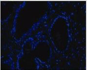 M6 Keratin 18 antibody （PEVIVA）（和光纯药工业株式会社）