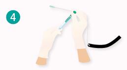 内窥镜专用检测棒LuciSwab ES（和光纯药工业株式会社）