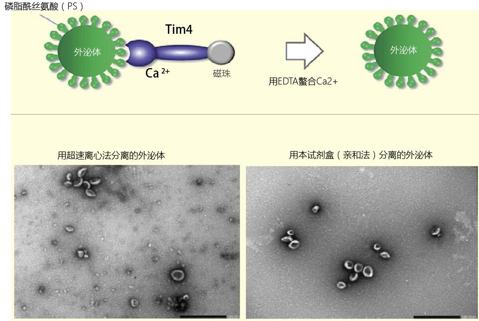 外泌体与肿瘤细胞转移及恶化的关联—外泌体提取试剂盒-价格-厂家-供应商-上海金畔生物科技有限公司