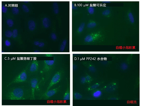 CYTO-ID® 自噬检测试剂盒                              CYTO-ID® Autophagy detection kit