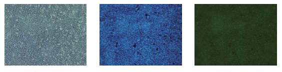 α-突触核蛋白聚集检测试剂盒                              (ALPHA)-Synuclein Aggregation Assay Kit