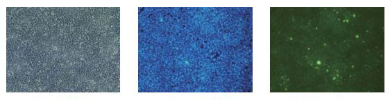 α-突触核蛋白聚集检测试剂盒                              (ALPHA)-Synuclein Aggregation Assay Kit