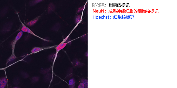 神经细胞用培养基