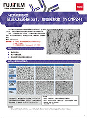 鼠源Iba1抗体，无标签，单克隆抗体（NCNP24）                              Anti Iba1, Monoclonal Antibody (NCNP24)