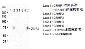 抗CRMP2，单克隆抗体（9F）                              Anti CRMP2, Monoclonal Antibody (9F)