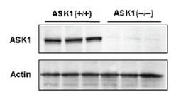 抗ASK1，单克隆抗体                              Anti ASK1, Monoclonal Antibody