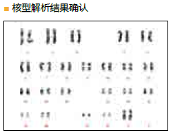 StemSure® 人多能干细胞培养基                              StemSure® hPSC Medium