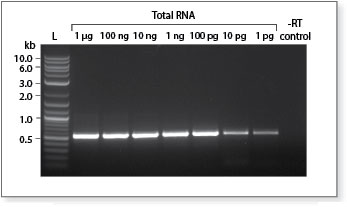 ProtoScript® II Reverse Transcriptase |